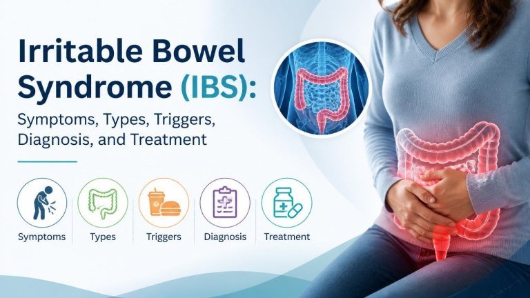 Irritable Bowel Syndrome (IBS): Symptoms, Types, Triggers, Diagnosis, and Treatment
